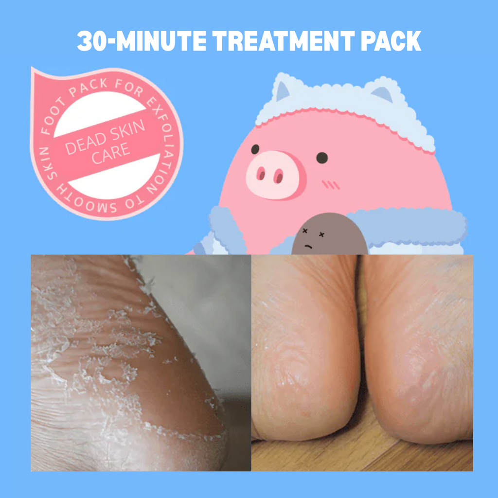 Peeling Dead Foot Pack