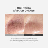 Blackhead melting Clear Pad