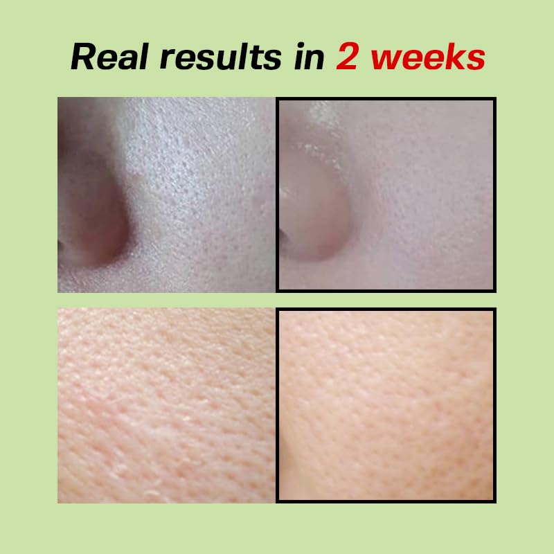 Green Tomato Pore Lifting Ampoule+, 30ml