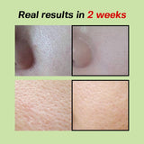 Green Tomato Pore Lifting Ampoule+, 30ml