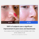 Zero Pore Pad
