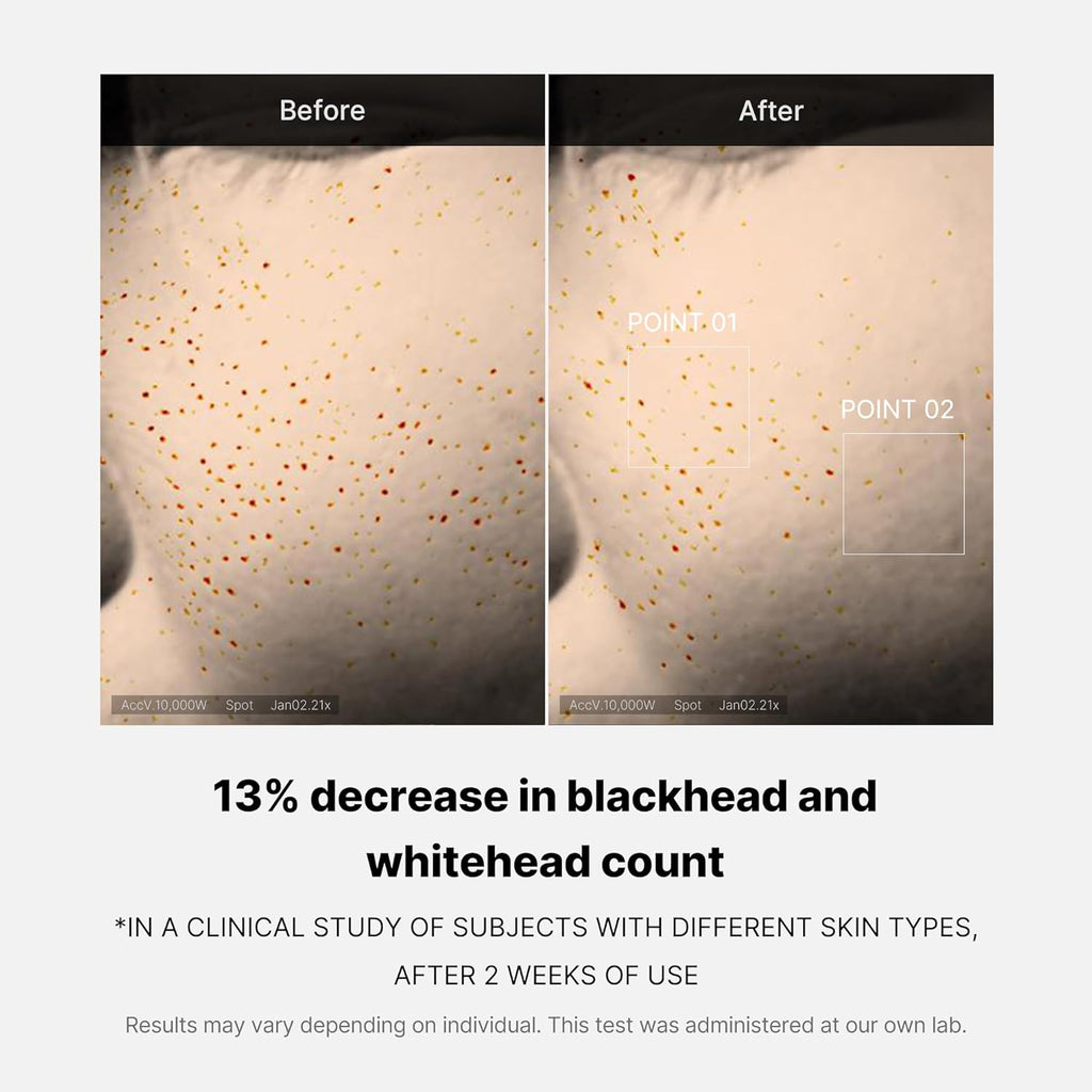 Zero Pore One Day Serum