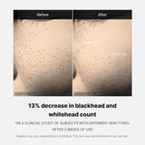 Zero Pore One Day Serum