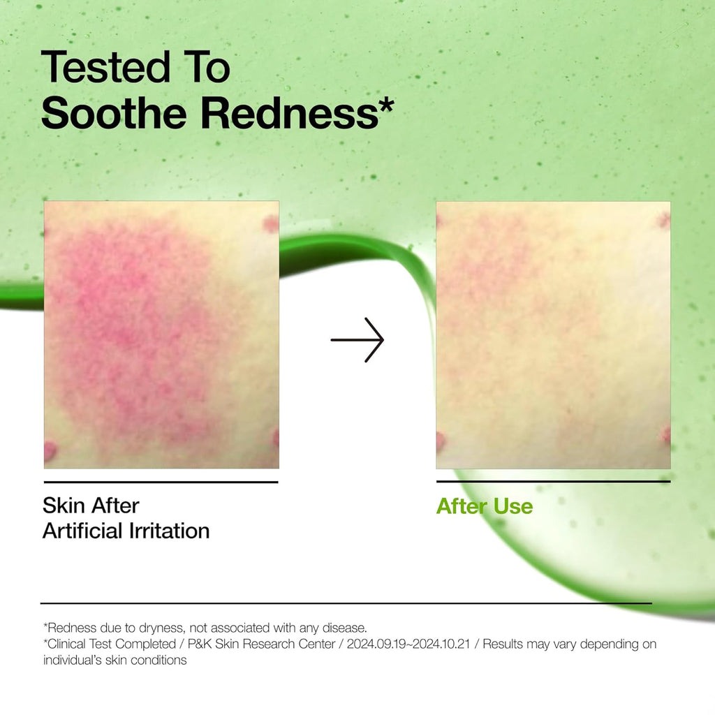 Azelaic 10 Hyaluron Redness Soothing Serum 30ml