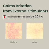 Green Flavonoid 2.5 Pads