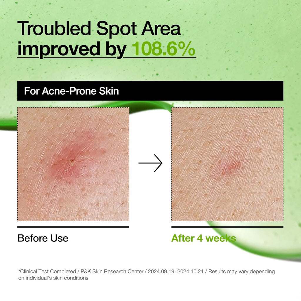 Azelaic 10 Hyaluron Redness Soothing Serum 30ml