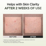9 Seaweed Spot Correcting Serum