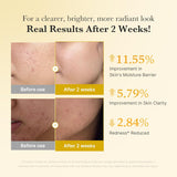 Kojic Acid Turmeric Niacinamide Serum, 30ml