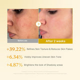 Kojic Acid Turmeric Resurfacing Toner, 250ml