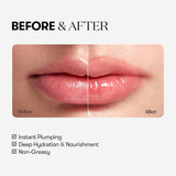 Reedle Shot Lip Plumper Beginner, 4.3g