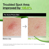 Azelaic 10 Hyaluron Redness Soothing Serum 30ml