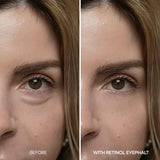 Eyephalt Retinal Eyebag Cream