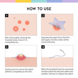 Star Spot Acne Patch - 80 Patches