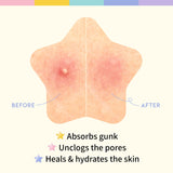 Star Spot Acne Patch - 80 Patches