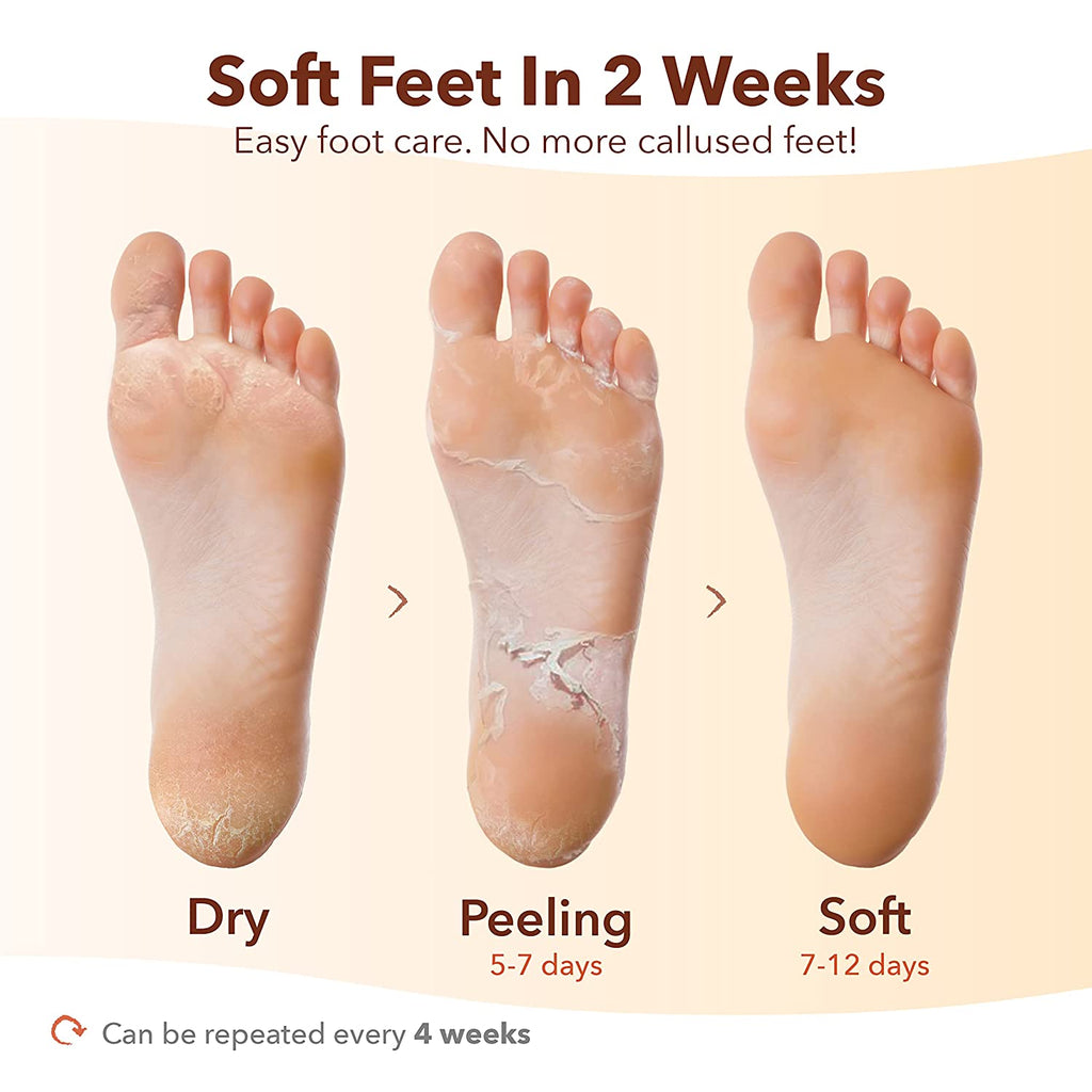 Exfoliating Foot Mask